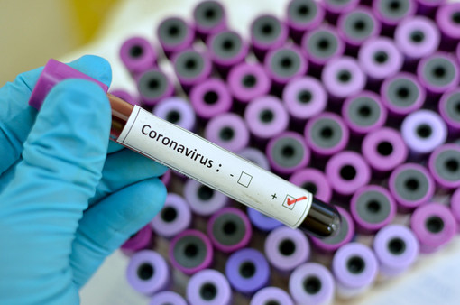 Coronavirus, salgono a 49 i casi positivi in Piemonte